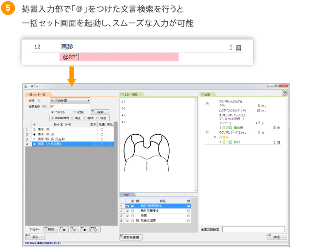 処置入力部で「＠」をつけた文言検索を行うと一括セット画面を起動し、スムーズな入力が可能